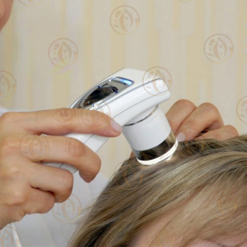 Лазерное лечение выпадения волос